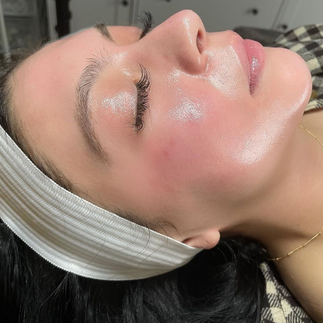 Skinbooster und Plasmabehandlung Basel – Hyaluronsäure-Injektion für strahlende Haut bei TREMP Plastic Surgery